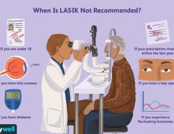 How Long Does Lasik Last