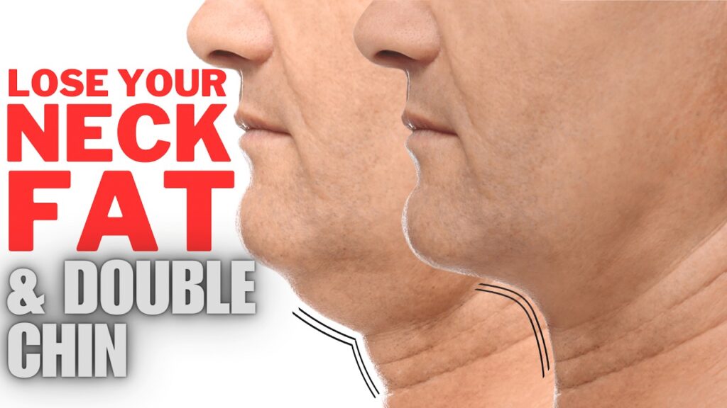 How to Lose Neck Fat